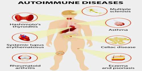 Autoimmune Disease Zoefact