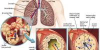 Report on Asthma