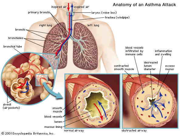 Report on Asthma