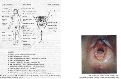 EXAMINATION OF A RAPE VICTIM