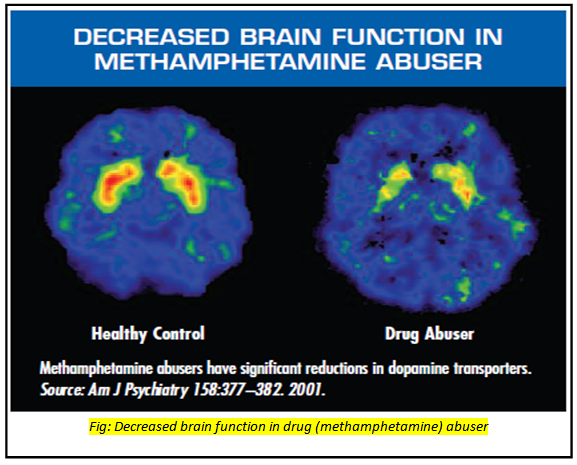 Long-Term Drug Abuse