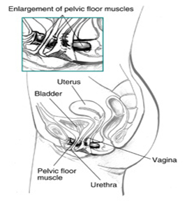 SIDE VIEW OF FEMALE PELVIC MUSCLE