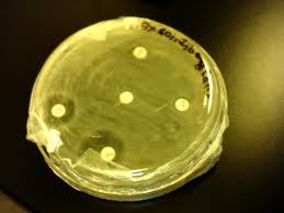 Microbial Investigation of Curcuma Longa