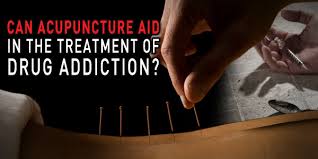 Acupuncture Treatment for Drug Addiction