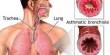 Three Warning Signs of an Asthma Attack
