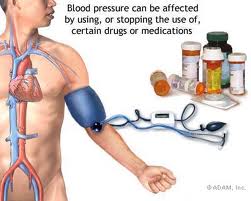 Basic Medical Treatments for Hypertension