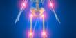 Acupuncture Can Relieve Arthritis Pain