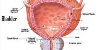 Bladder Infection Symptoms and Treatment Methods