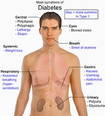 The Facts about Diabetes Mellitus
