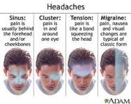 Effective Ways to Get Rid of Headache Naturally