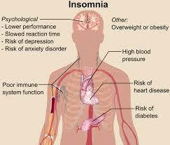 Acupuncture is a Natural Remedy for Insomnia