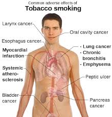 Presentation on Bad Effects of Smoking