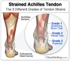 Reasons of Achilles Tendon Pain