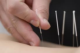 Advantages of Acupuncture Treatment