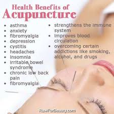 Advantages of Acupuncture