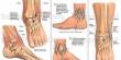 Symptoms and Causes of Ankle Fractures in Kids