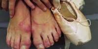 How to Prevent Blistered Feet