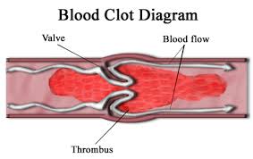 Breakdown to Prevent Blood Clots