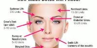 Side Effects of Botox Treatment