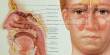 Explain Chronic Sinus Infection