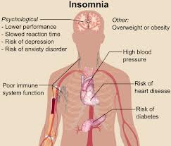 Natural Treatment for Cure Insomnia