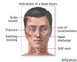 Cause of Head Trauma Injury