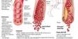 Explain Peripheral Arterial Disease