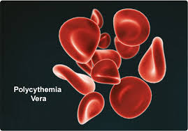 Explain Polycythemia Vera