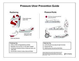 Pressure Ulcer Prevention Method