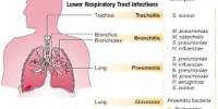 What are the Respiratory Infections