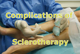 Benefits of Sclerotherapy Training