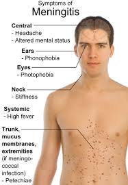 Spotting the Signs of Meningitis