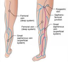 Spider Vein Treatment for Healthy Life