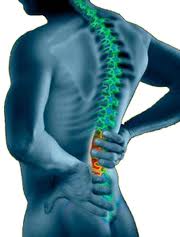 Dealing with Spine Surgery
