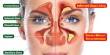 What are the Symptoms of Sinusitis
