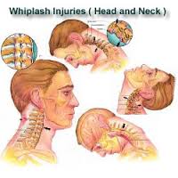 Whiplash Orthopaedic Conditions
