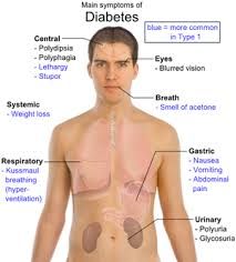 Define on Diabetes Life Expectancy