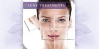 Define and Discuss on Acne Treatment