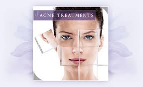 Define and Discuss on Acne Treatment