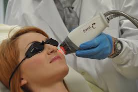Define on Hair Removal Laser Treatment