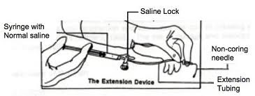 Saline Lock