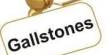 Know About Gallstones