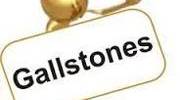 Know About Gallstones