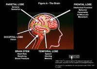 About Hypoxic Brain Injury