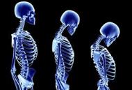 About Osteoporosis