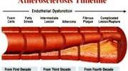 About Atherosclerosis