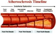 About Atherosclerosis