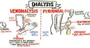 Kinds of Dialysis