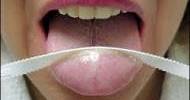 Tongue and Bad Breath