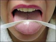 Tongue and Bad Breath